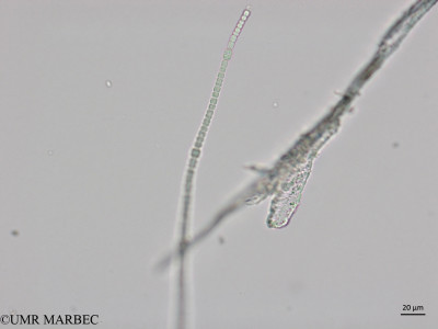 phyto/Brazilian_Nordeste/Northeastcoast_station31/ABRACOS2 April 2017/Anabaena sp2 (Snap-256)(copy)_thumb.jpg